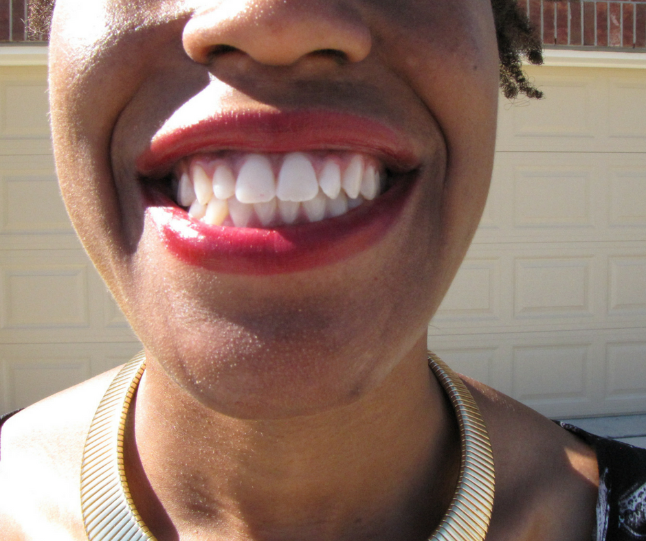 teeth whitening 